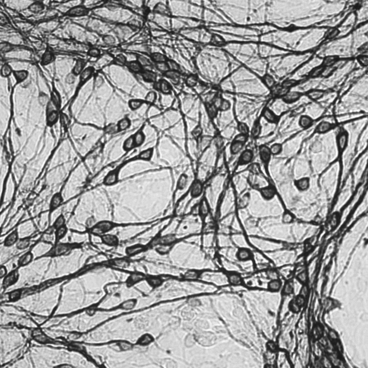 Future Aborted (live in Portland) (single)