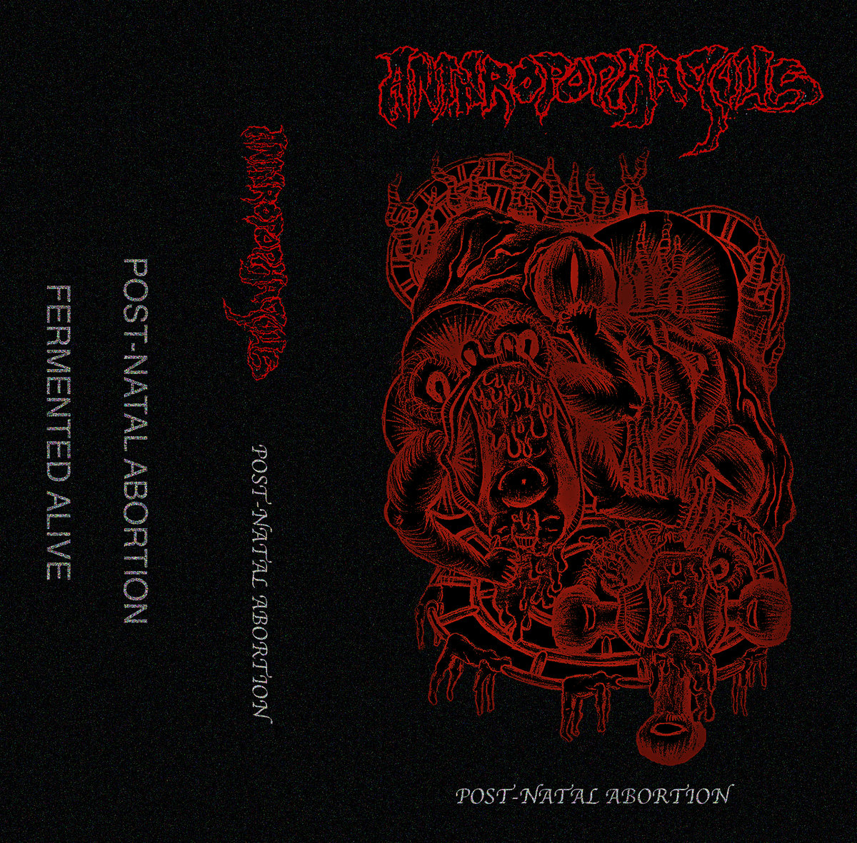 Post-Natal Abortion Demo