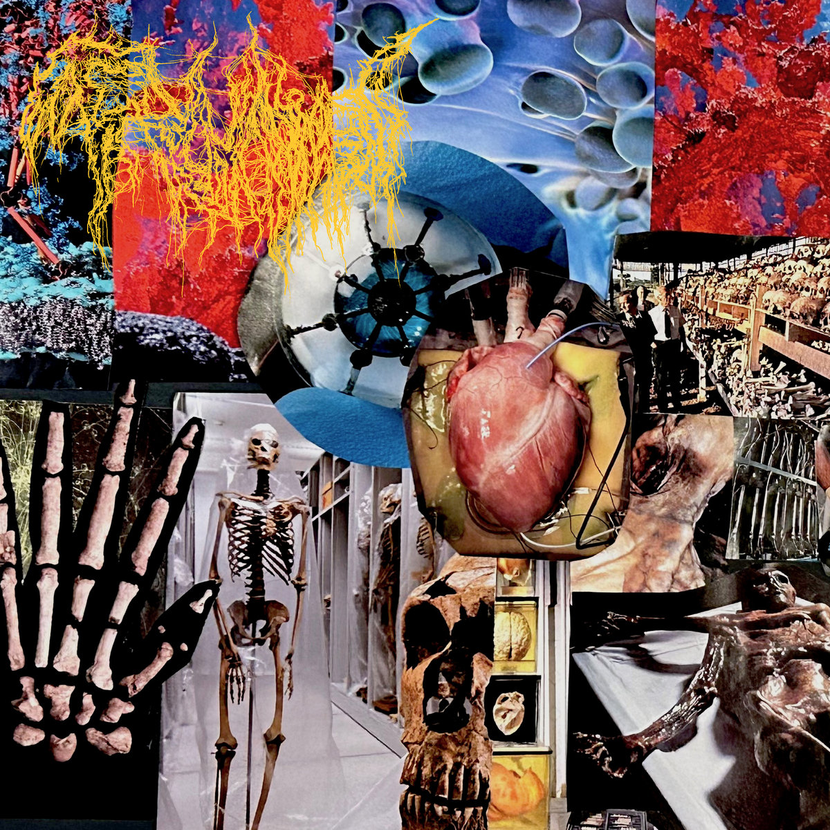 Harvest Of The Killing Fields