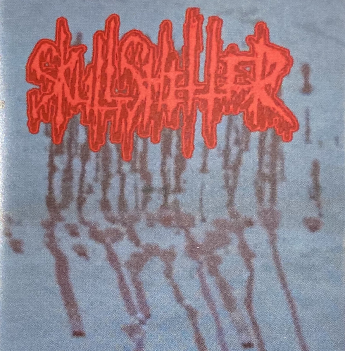 Distal Humerus Fracture: Live