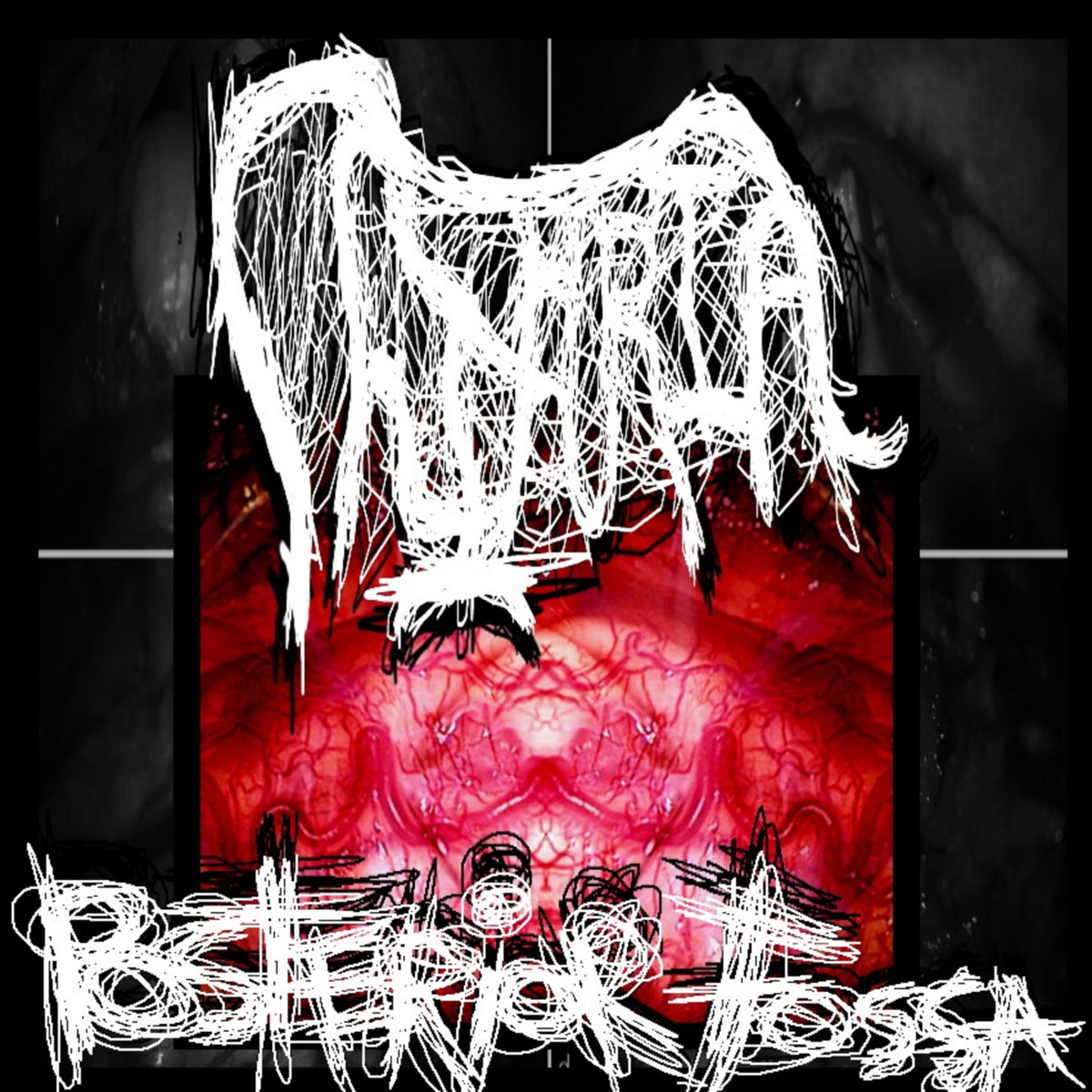 Posterior Fossa Demo