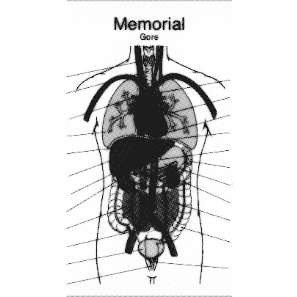 Endless Gore -- Cassette
