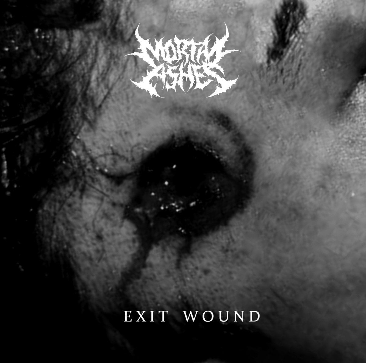 Exit Wound