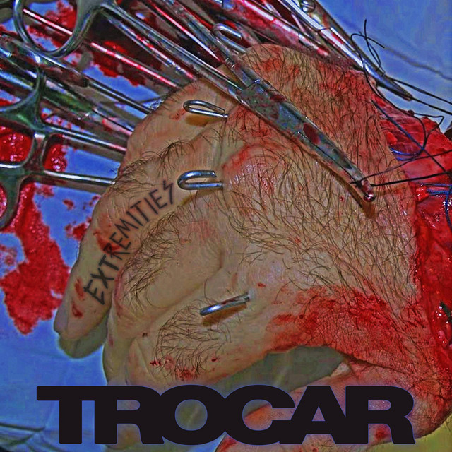 Trocar