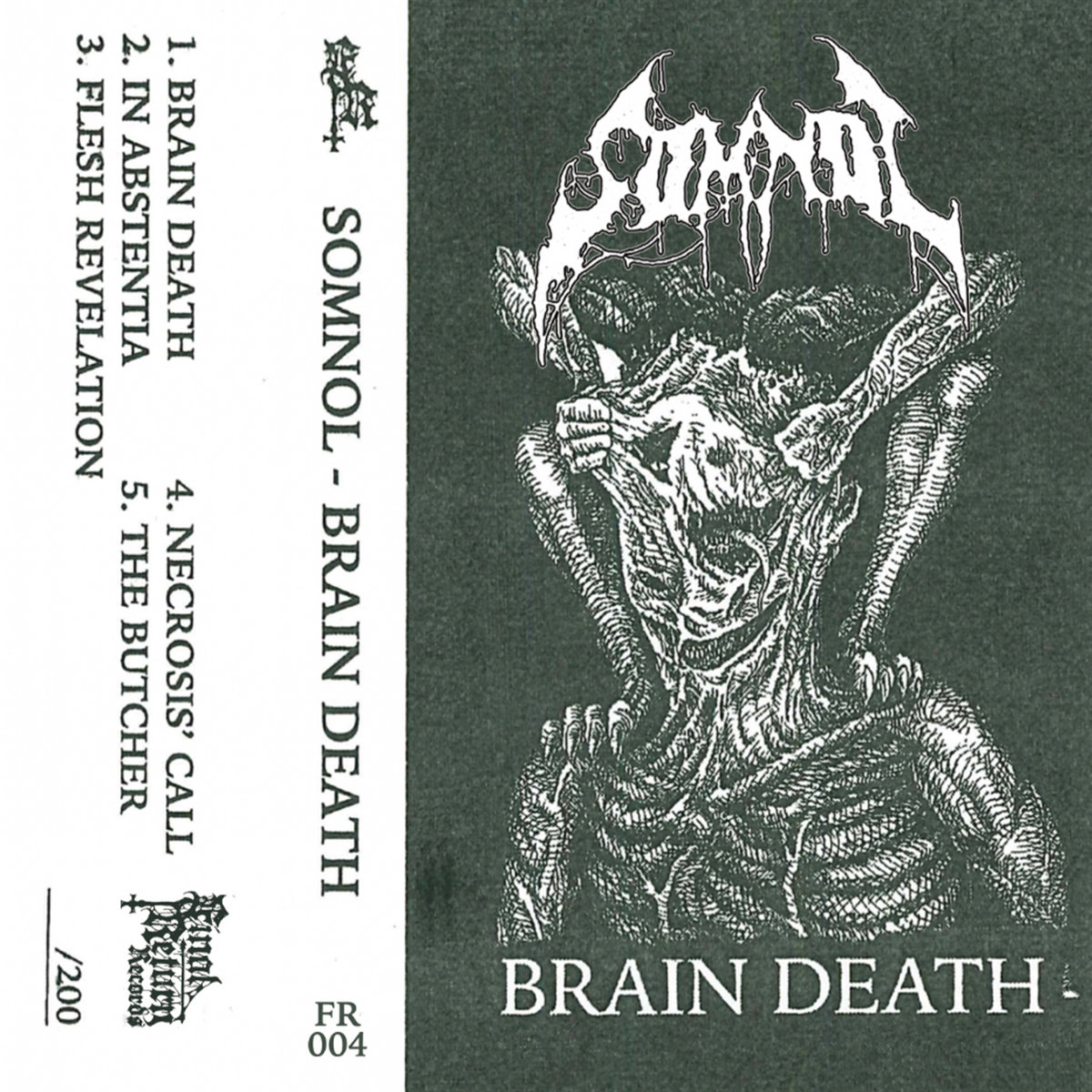 Brain Death