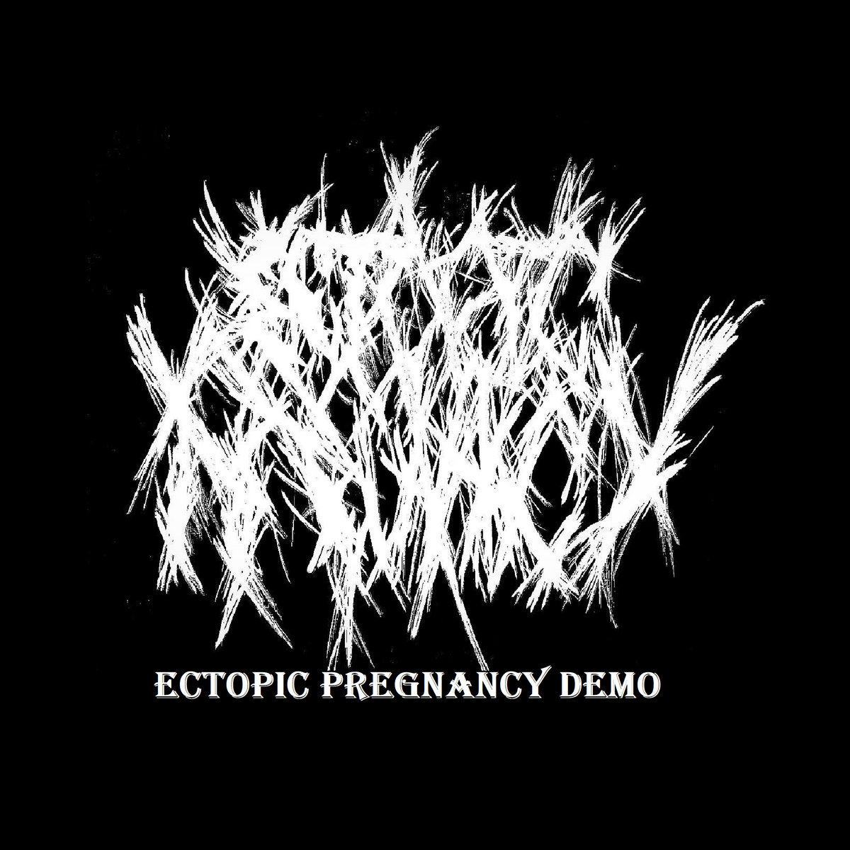 Ectopic Pregnancy Demo