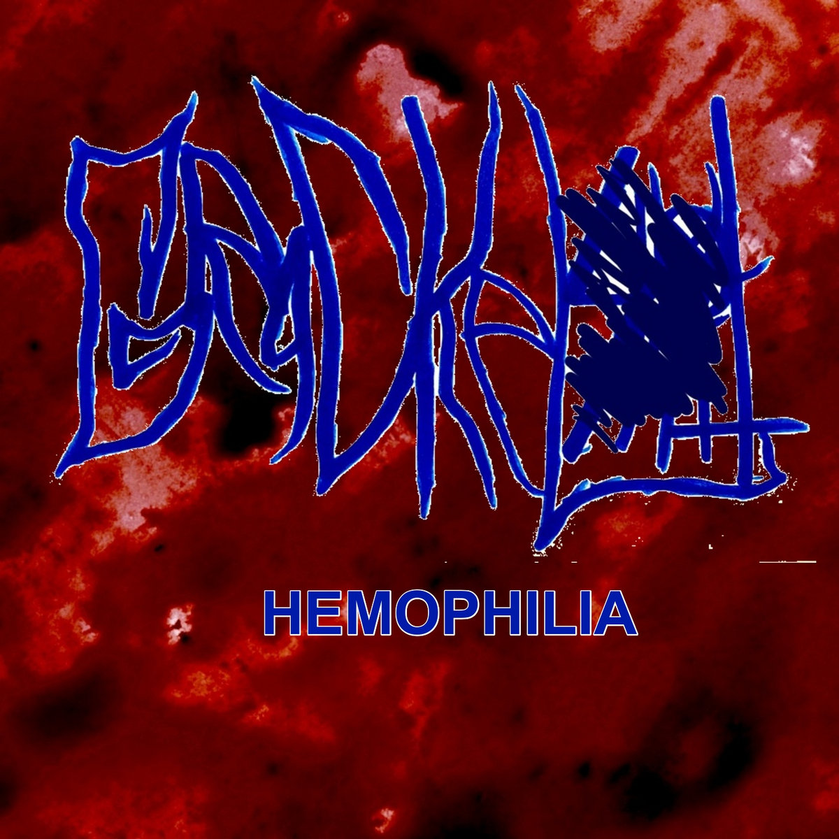 Hemophilia