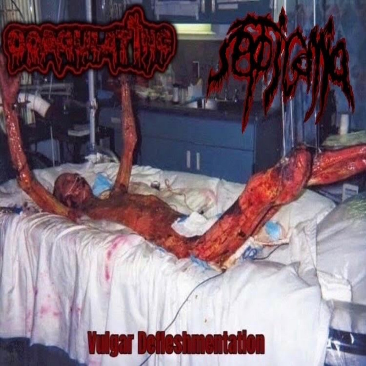 Vulgar Defleshmentation (Coagulating Side)