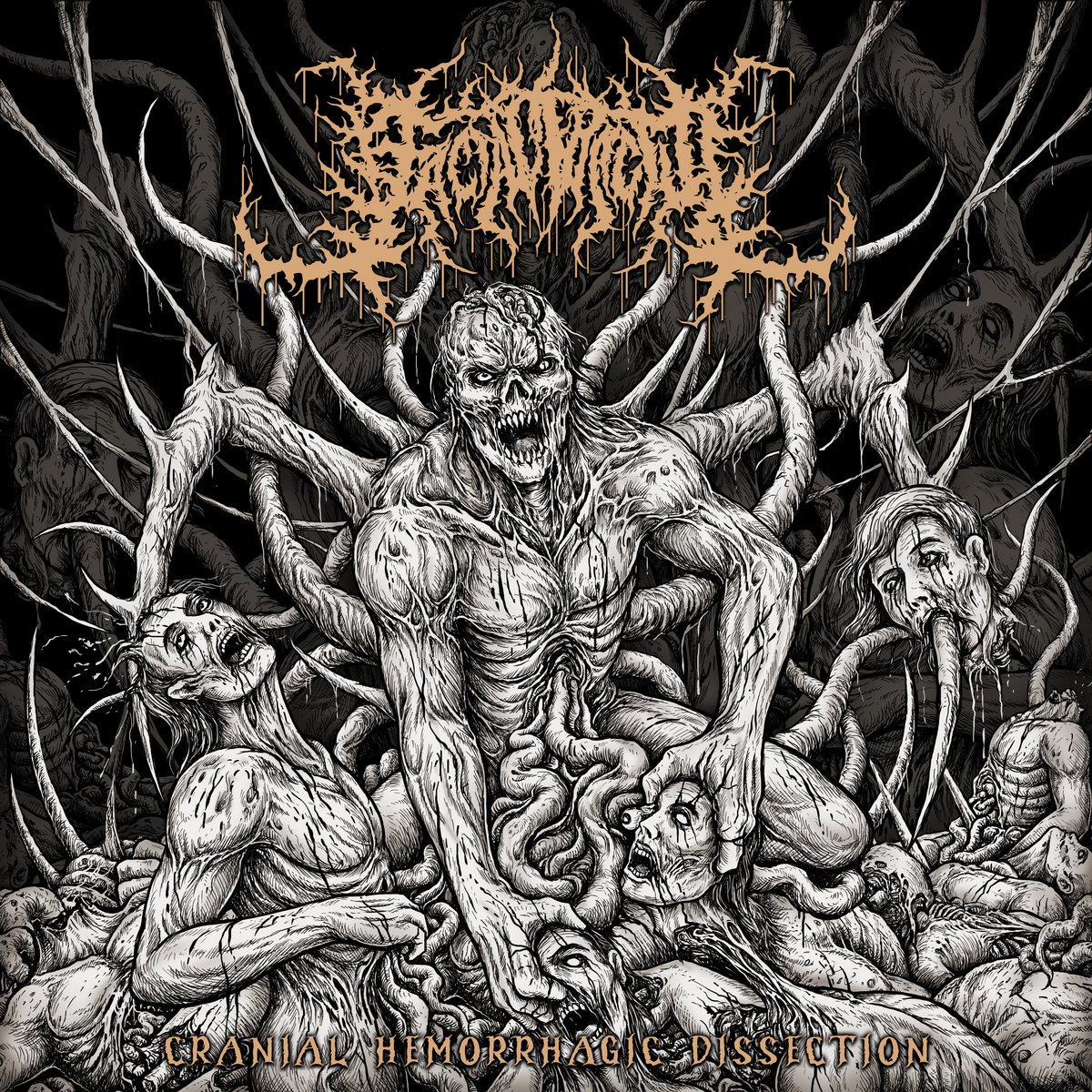 Cranial Hemorrhagic Dissection