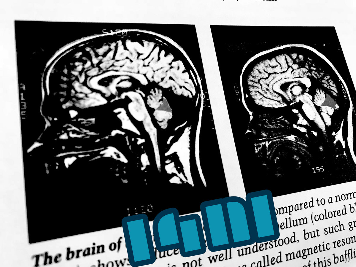 “Two Sides of the Same Brain” pt.2