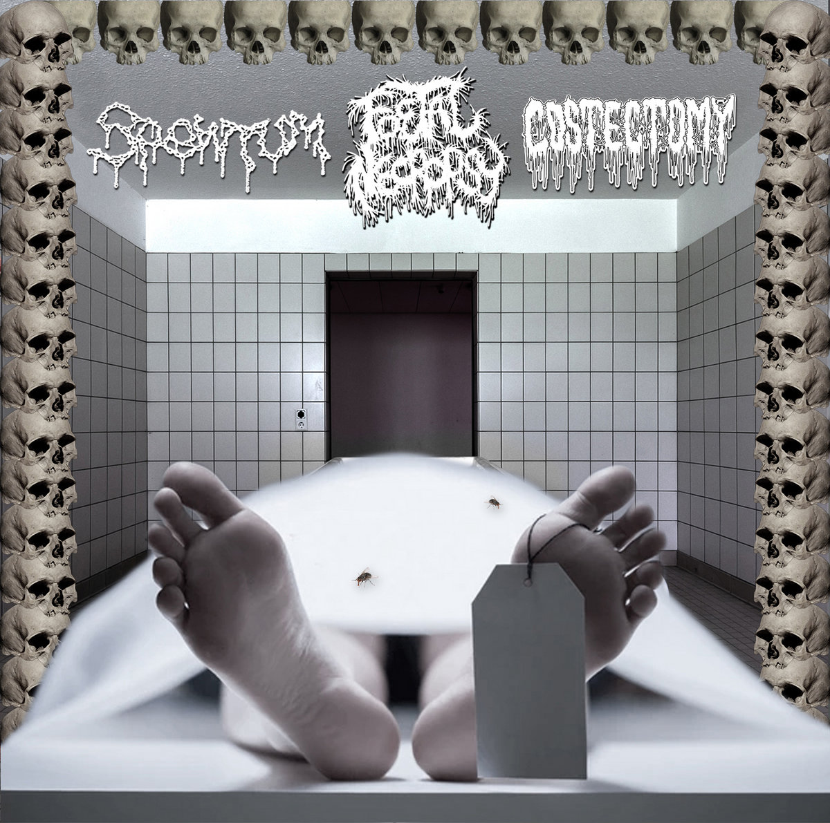 SPLIT WITH FOETAL NECROPSY & SPEWTUM
