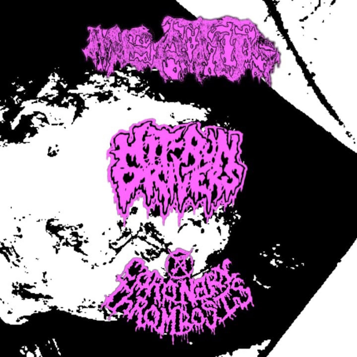 3 Way Split w/ Meatus / Hit-Run Drivers