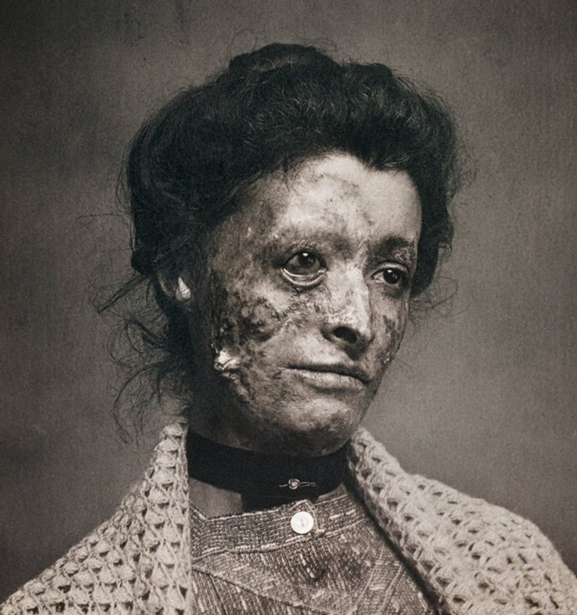 Generational Filth, Infected Futures