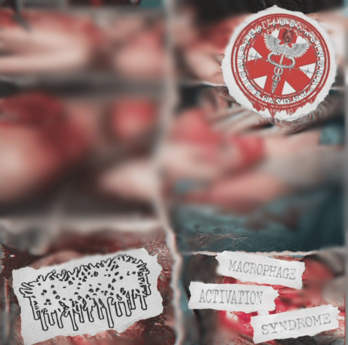 MACROPHAGE ACTIVATION SYNDROME SPLIT WITH MXTXA