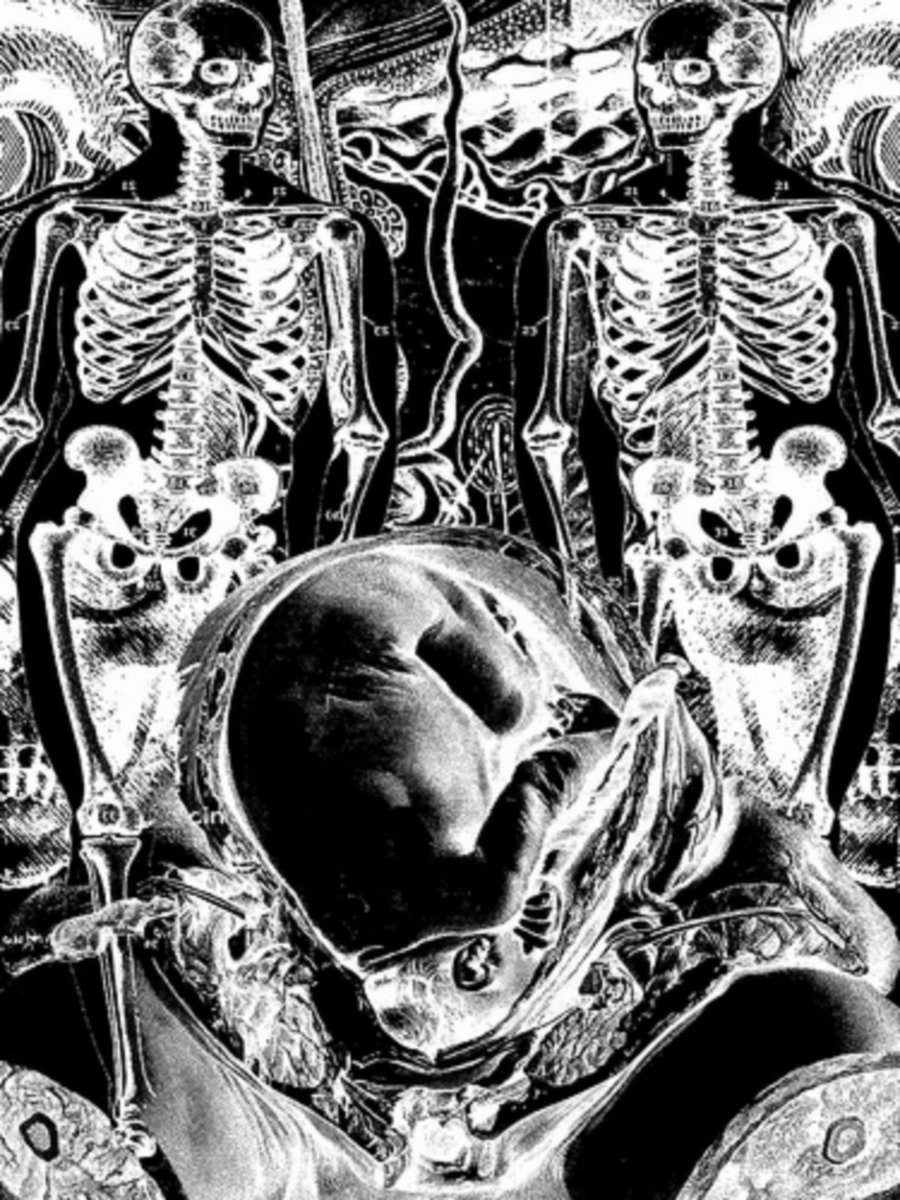 Cloak of Displacement / Blood Escutcheon