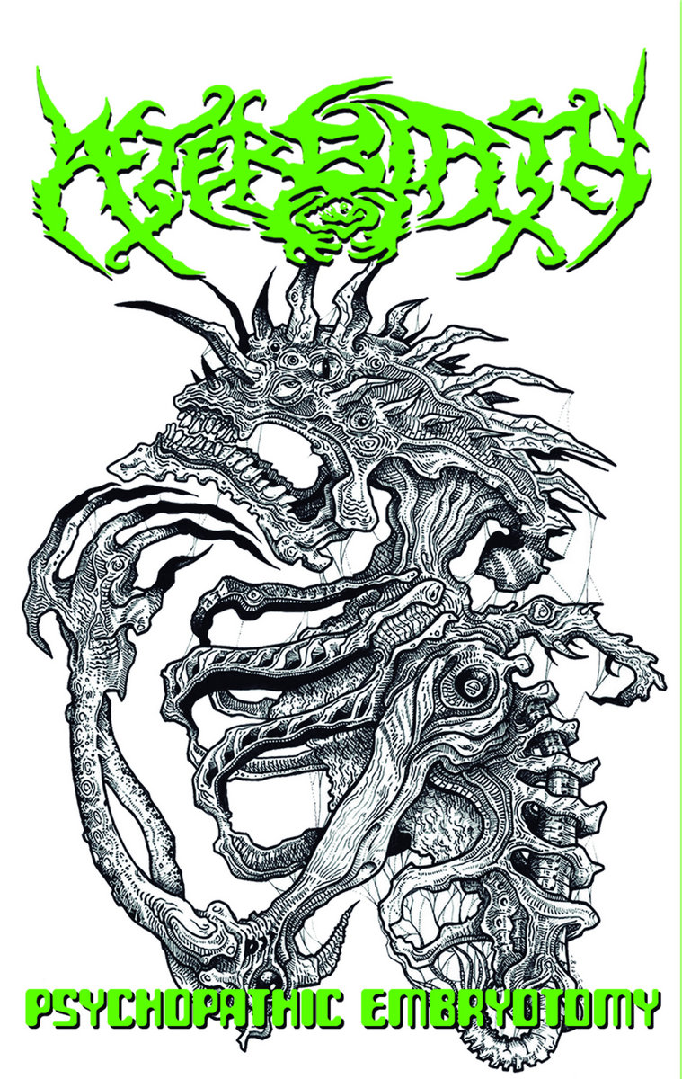 Psychopathic Embryotomy