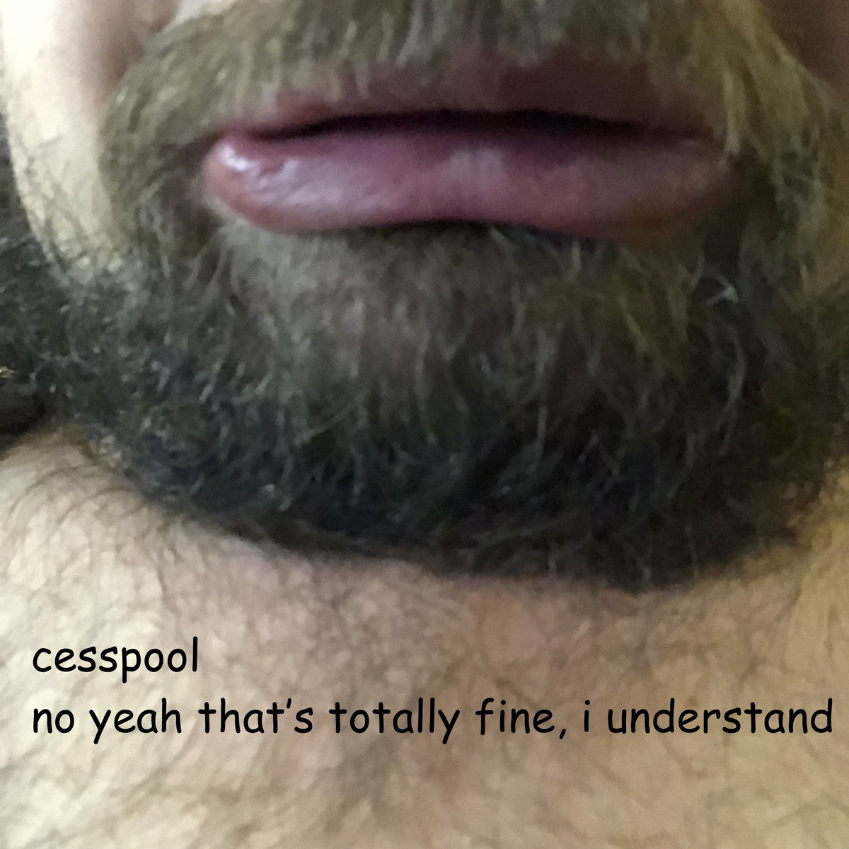 no yeah that's totally fine, i understand