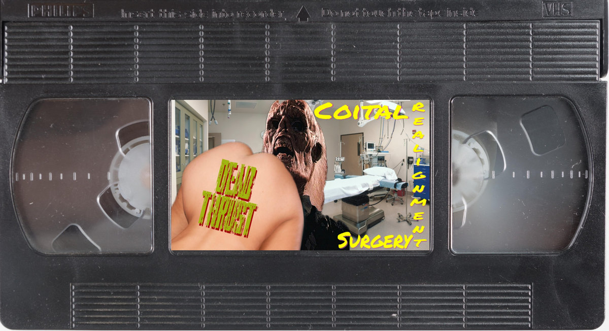 Coital Realignment Surgery