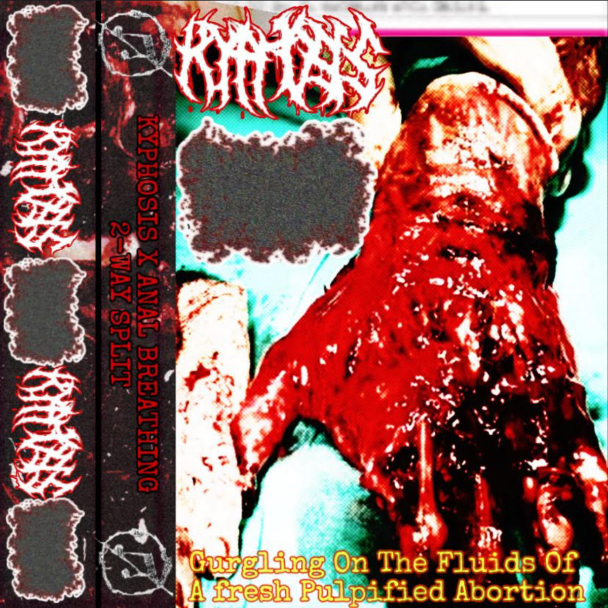 gurgling on the fluids of a fresh pulpified abortion (kyphosis side)