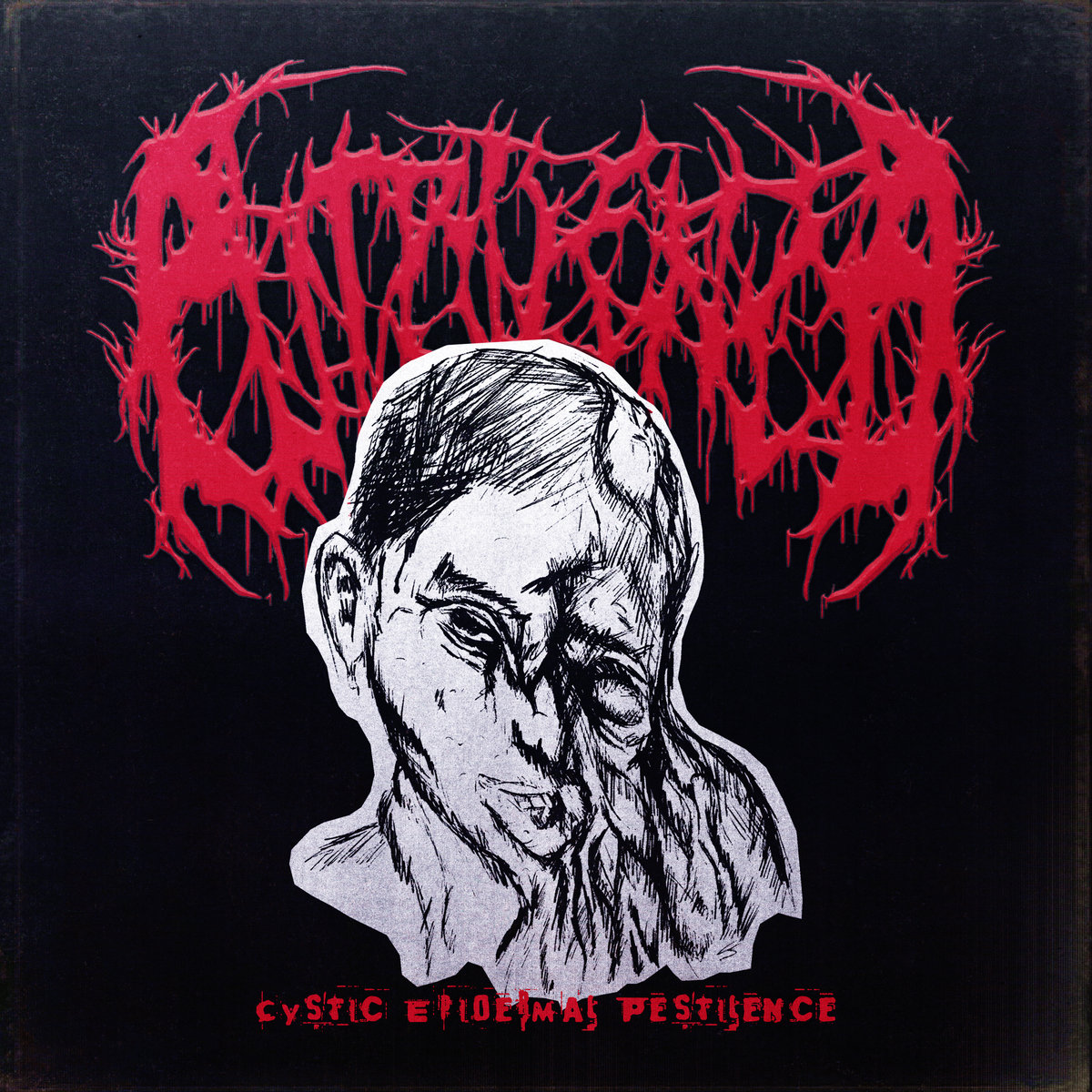Cystic Epidermal Pestilence