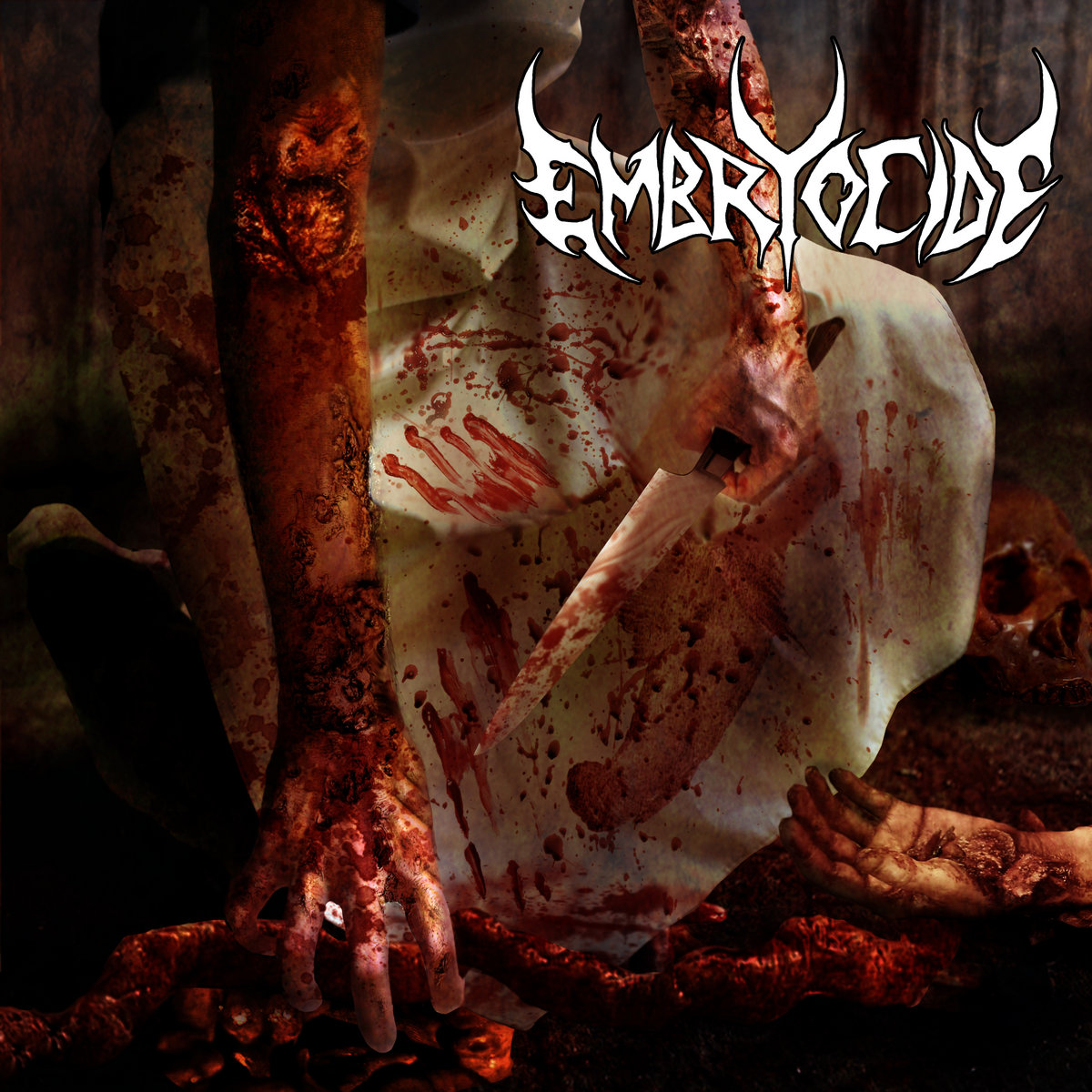 Embryocide