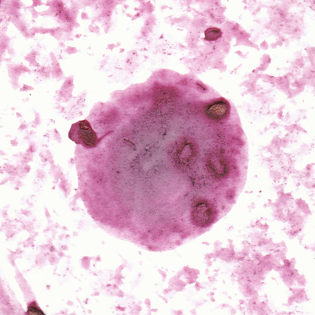 A Year Without Summer