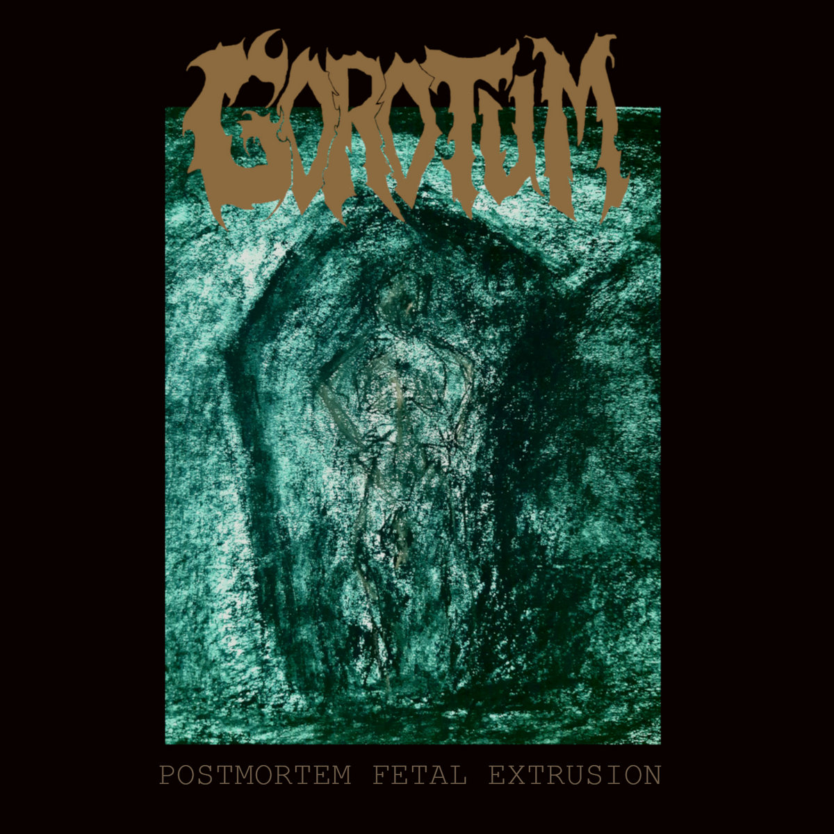 POSTMORTEM FETAL EXTRUSION