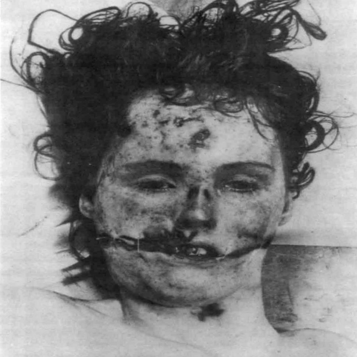 You Think You Know About Pain?