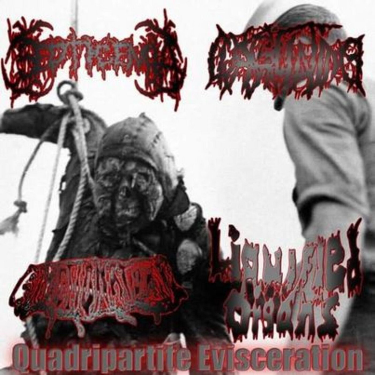 Quadripartite Evisceration (Coagulating Side)