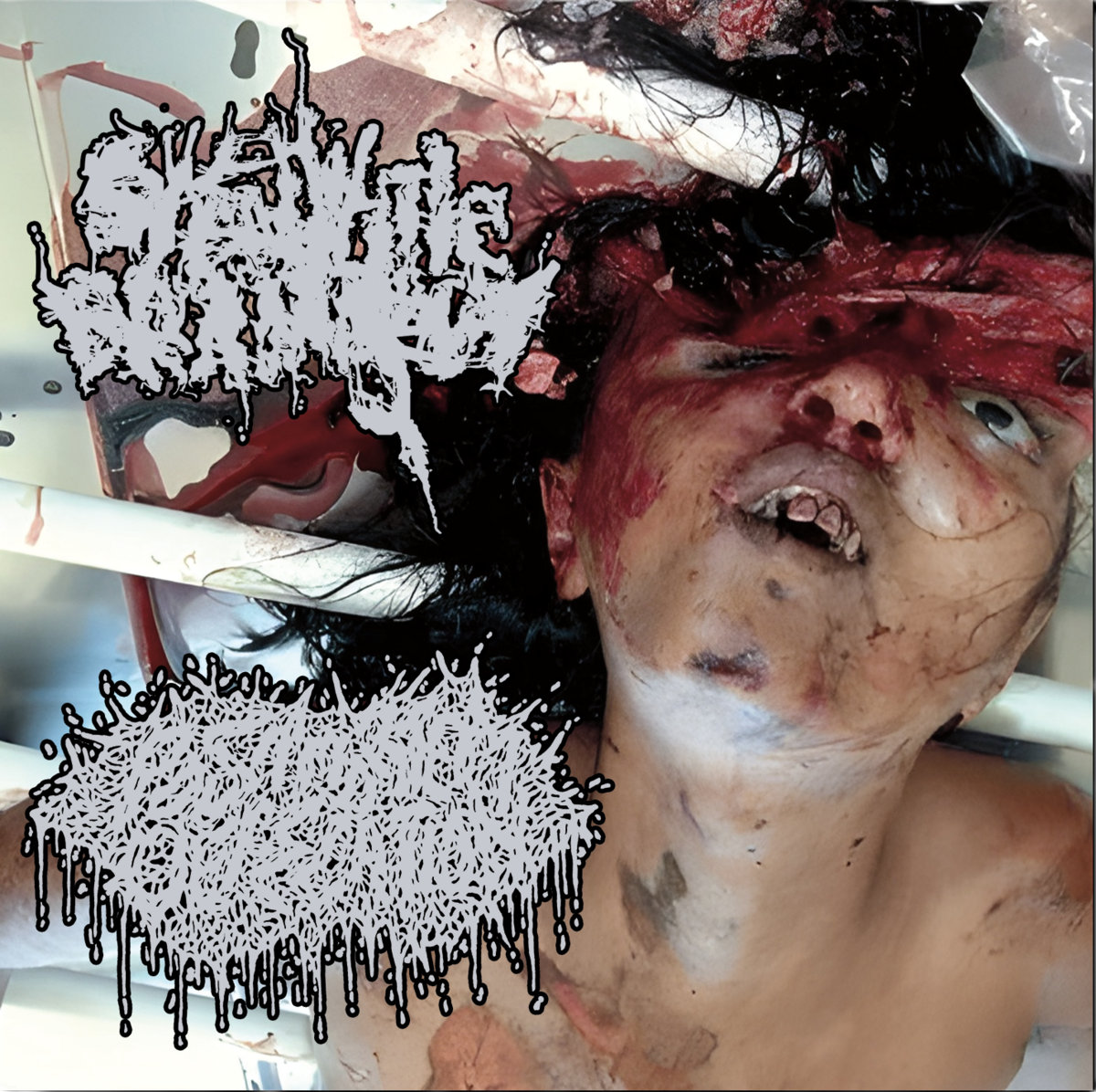 split w/ Syphilitic Brain Rot
