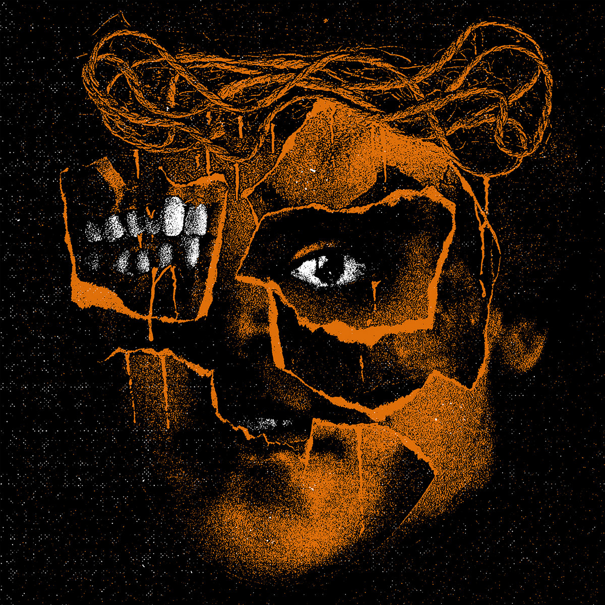 Crowning the Cadaver