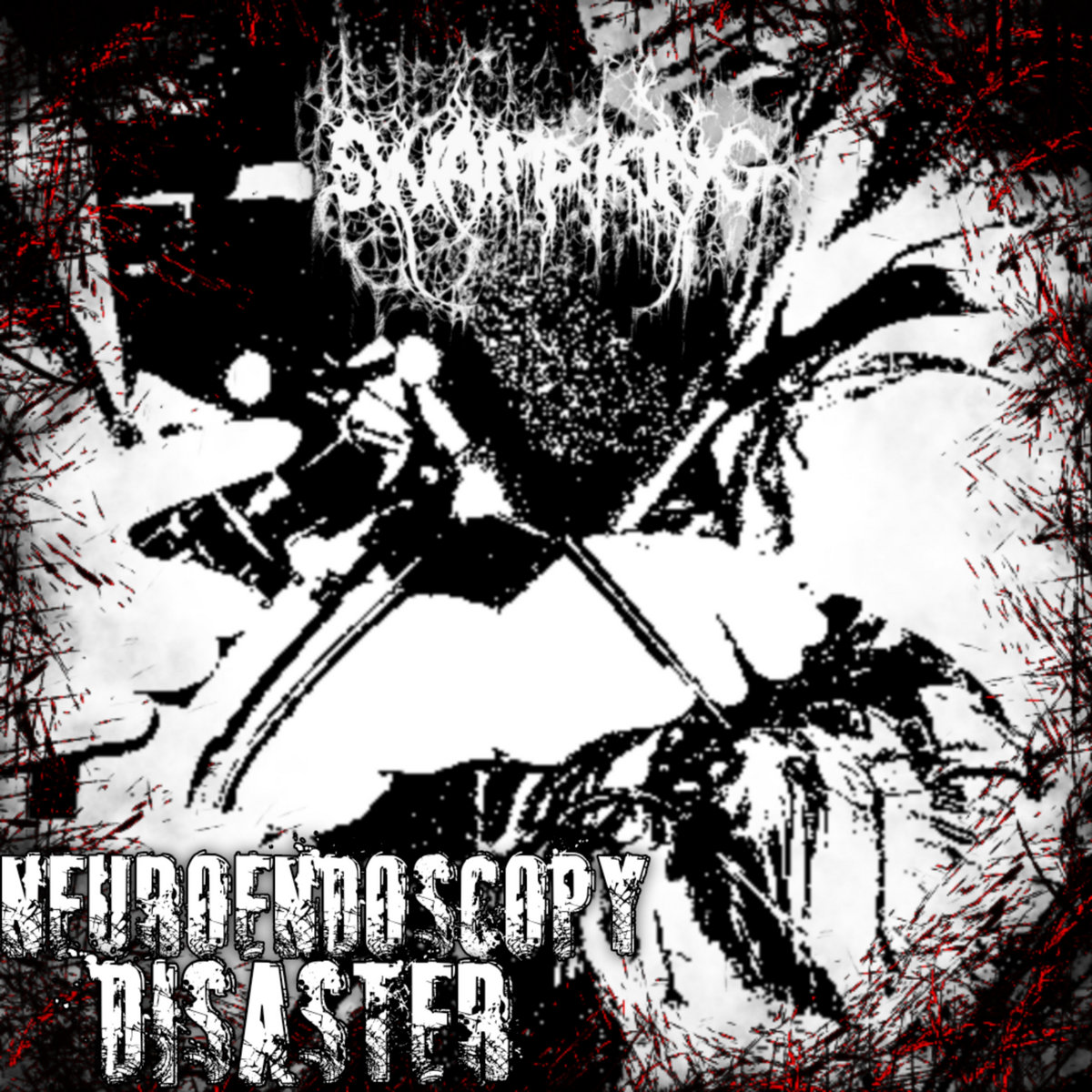 Neuroendoscopy Disaster