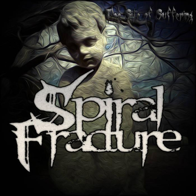 Spiral Fracture