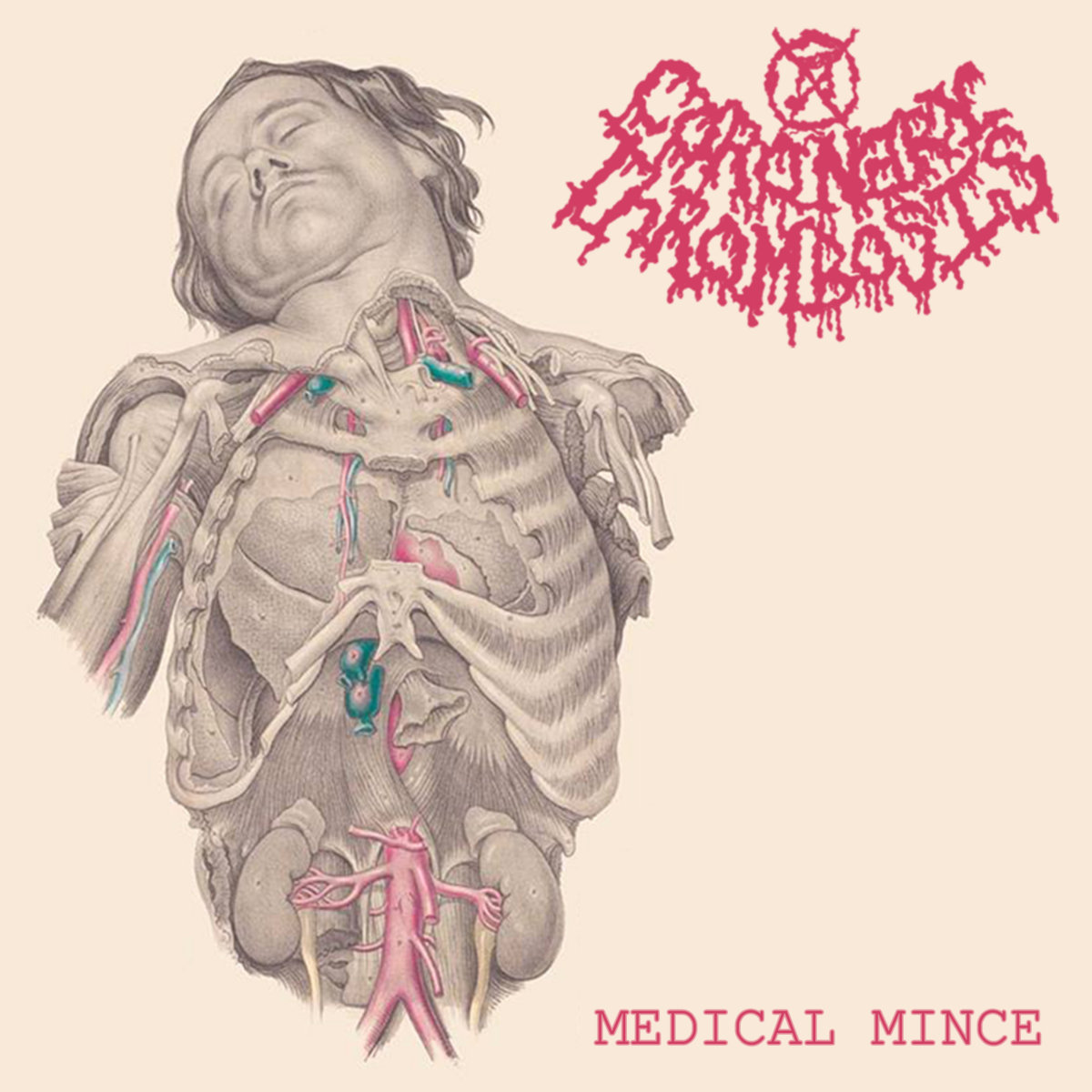 Medical Mince (teaser)