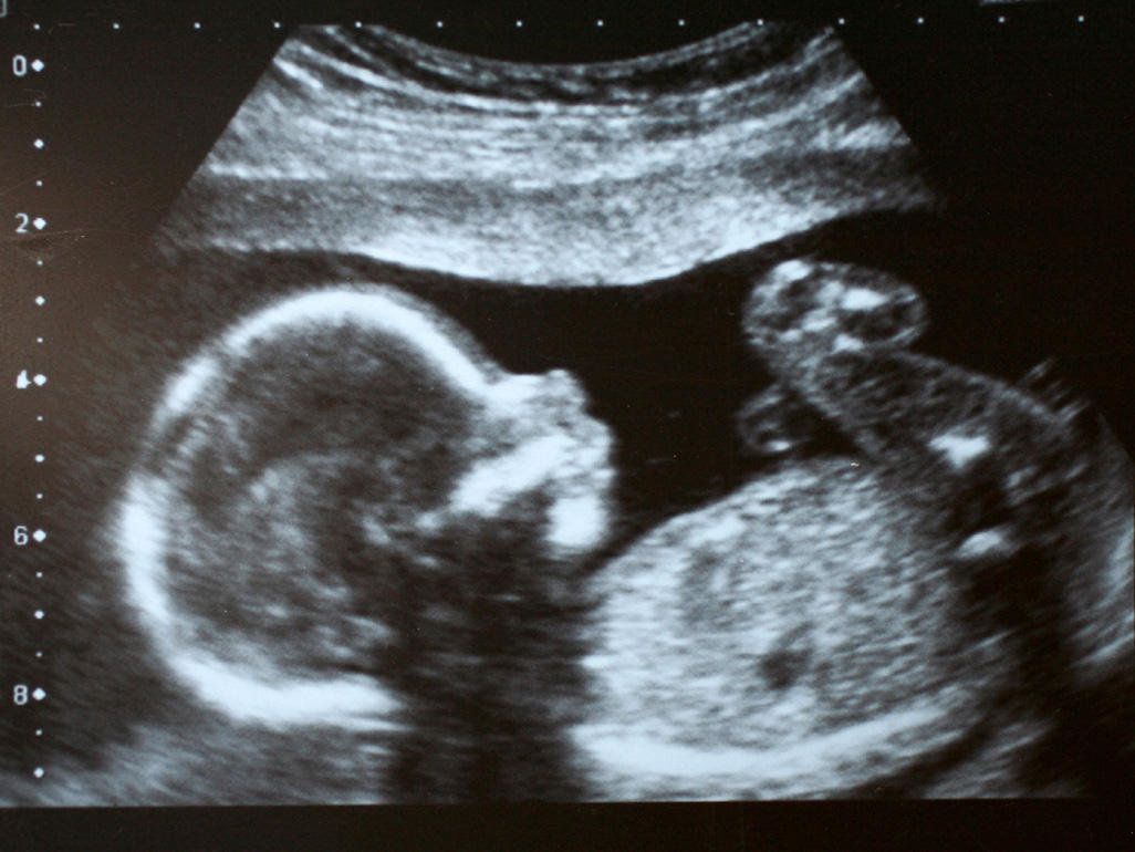 SHIT ENCRUSTED WOMB ft. Lil Wayne