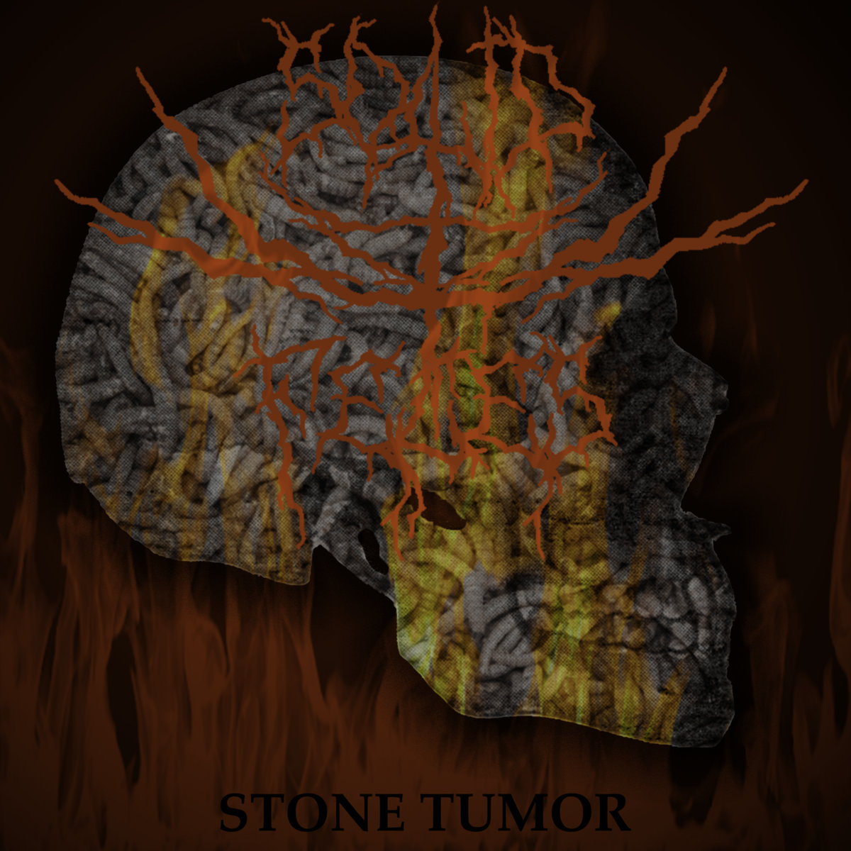 Stone Tumor (Demo EP)