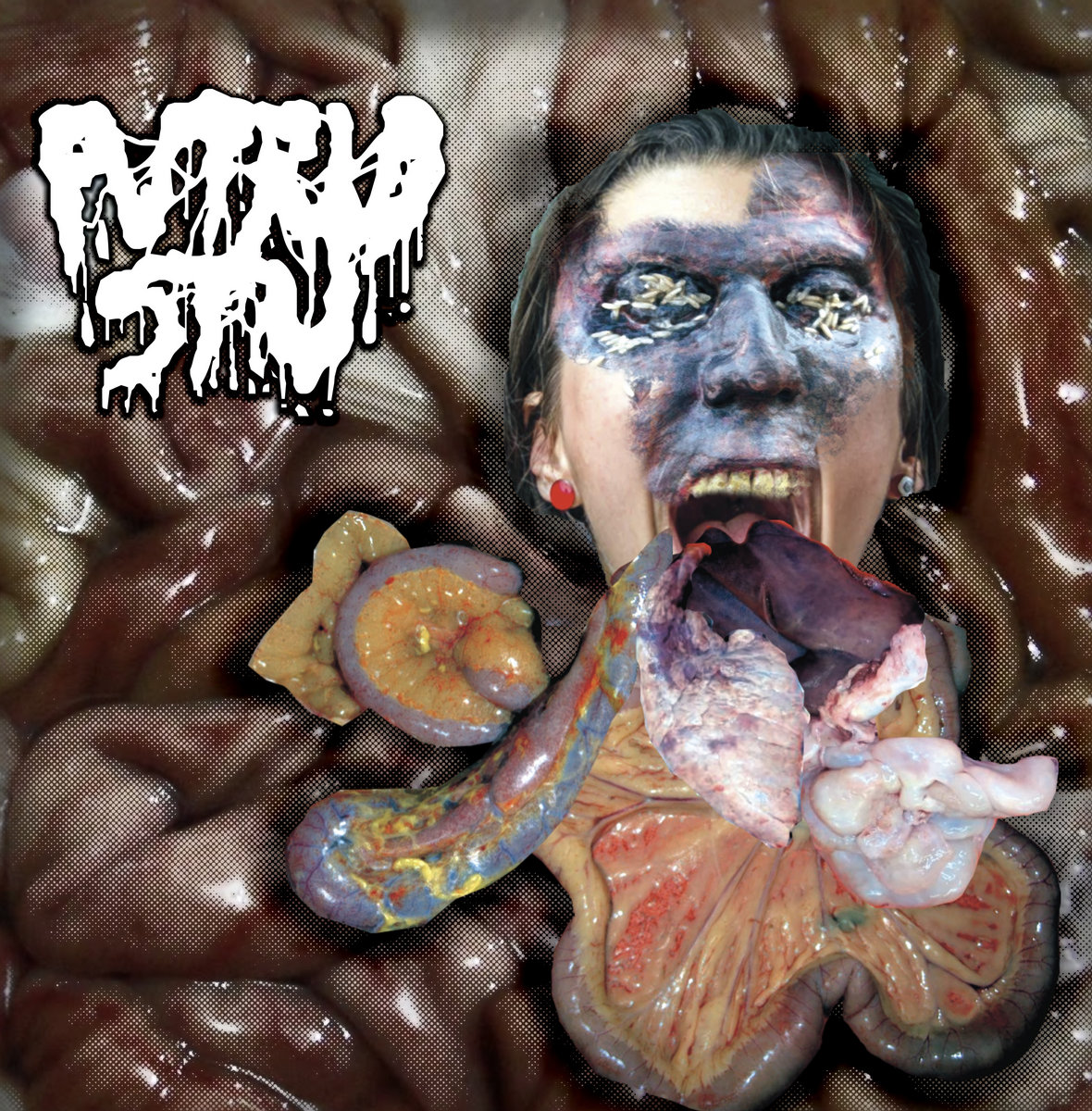 Amidst an Anal-Analgesic Assembly