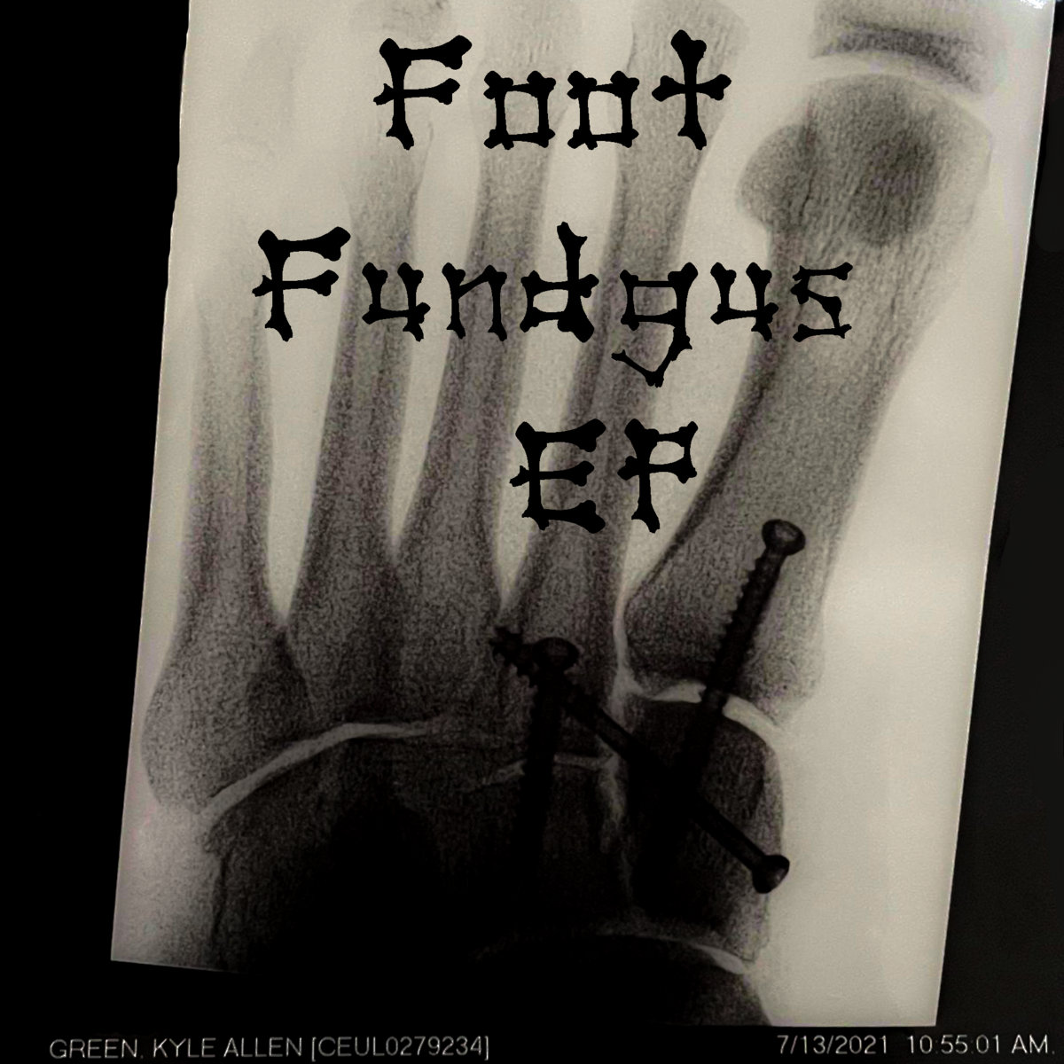 Foot Fundgus EP