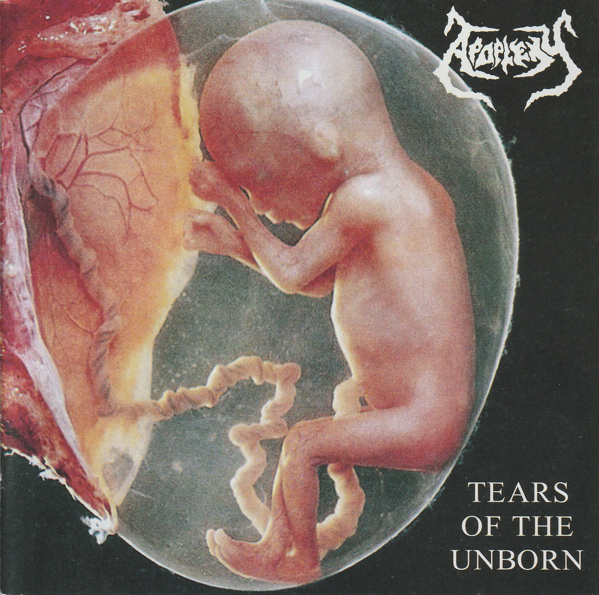 Tears of the Unborn