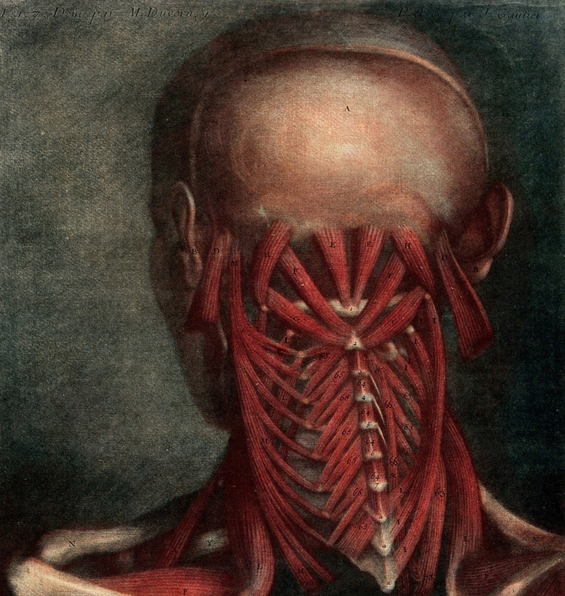 Mount Massive Asylum