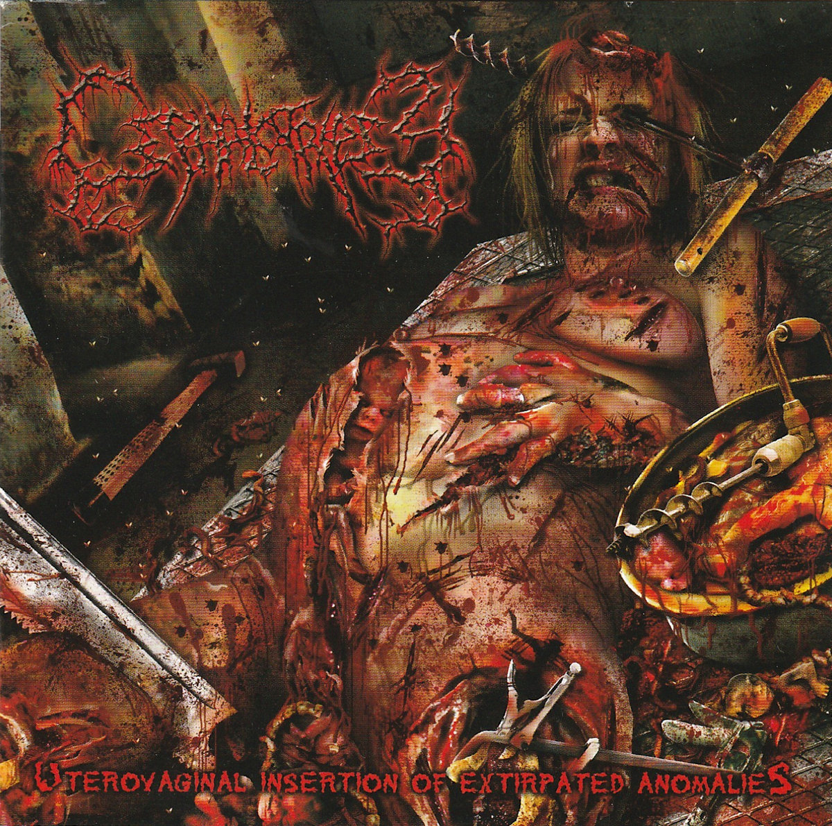 Uterovaginal Insertion of Extirpated Anomalies