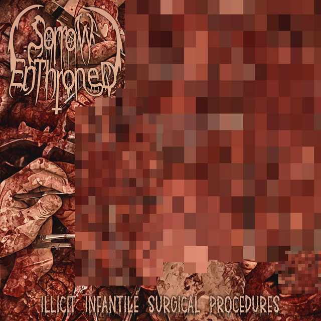 Illicit Infantile Surgical Procedures