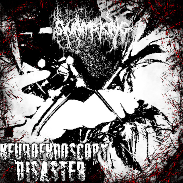 Neuroendoscopy Disaster