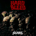 SCABS