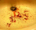 Skinned Alive