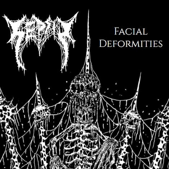 Facial Deformities