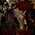 Barbed Wire Strangulation