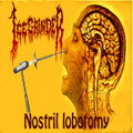 Nostril Lobotomy