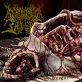 Wretched Abdoment Replacement (ft Angel Ochoa)