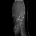 Beg to differ